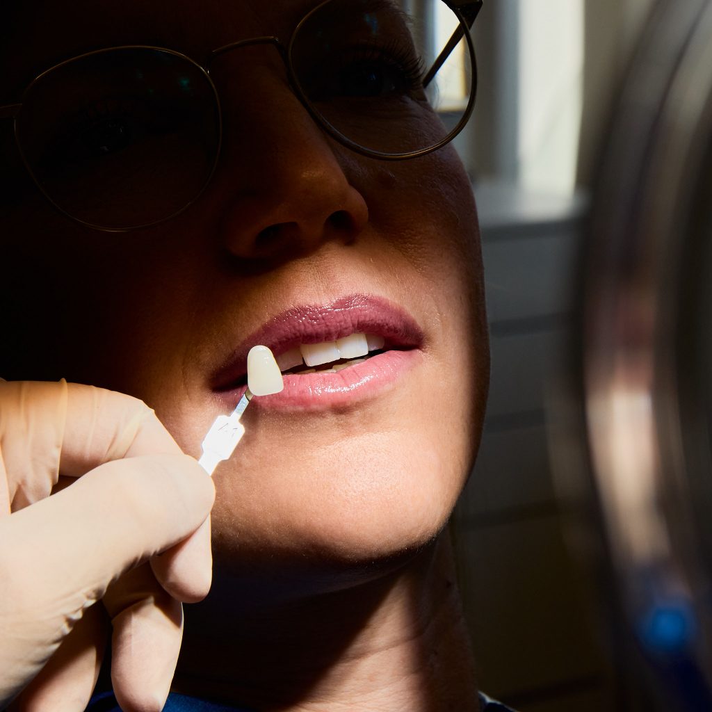 Ästhetische Zahnmedizin in der Praxis Zahnmedizin Rindermarkt – hier: Veneers